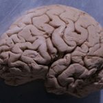 The Science Behind Seizures